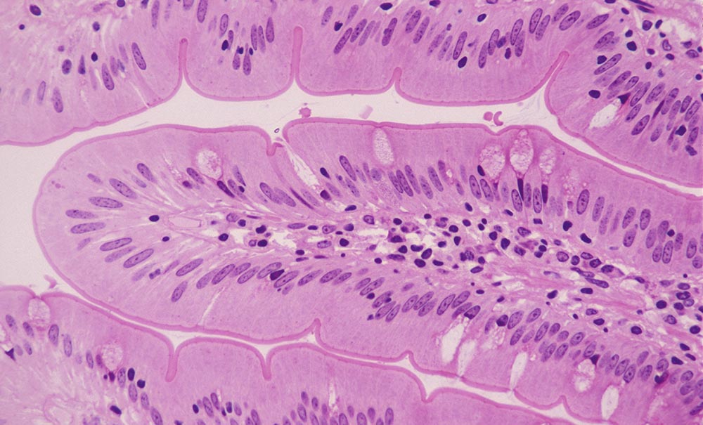 Photo of purple stained cells from the cross-section of a villus from the walls of the small intestine.