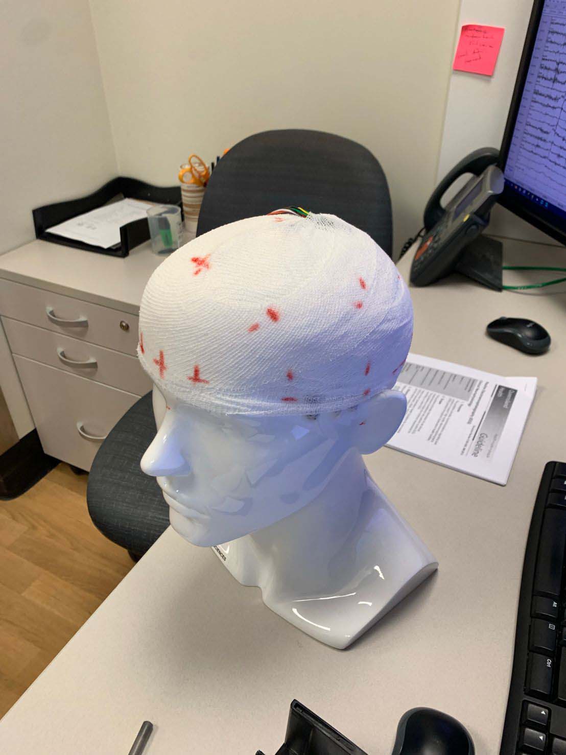 A model of a human head with markings mapping areas of the brain.