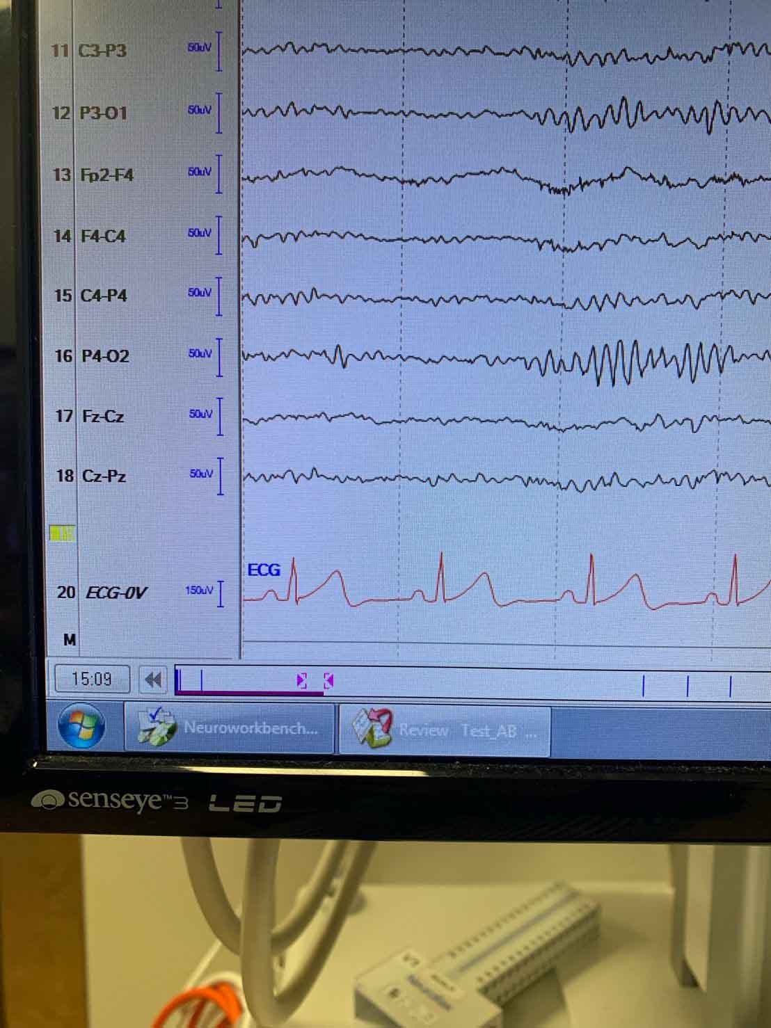 A computer monitor showing the results of a brain scan.