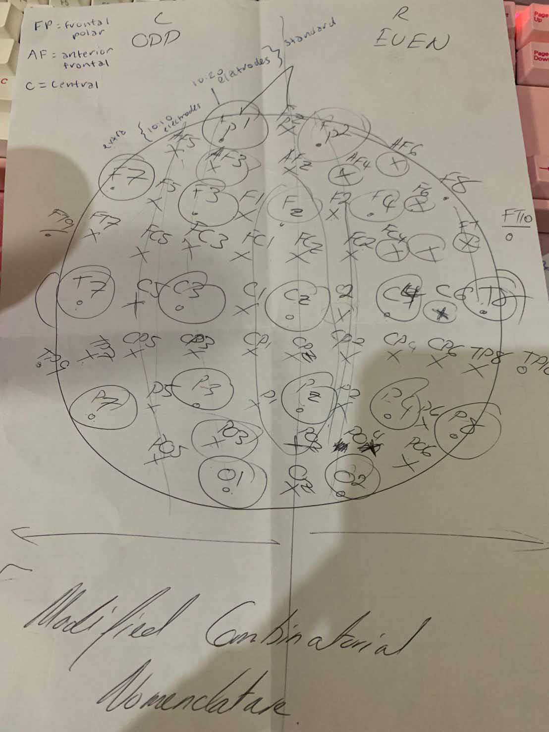 Hand written notes from a brain scan.