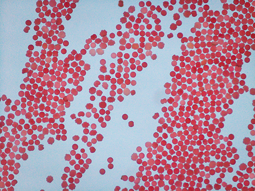 red balls of coral spawn